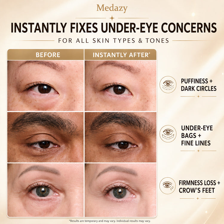 Medazy Instant Face Tightener – Visible Smoothing in 60 Seconds, Progressive Results in 18 Days