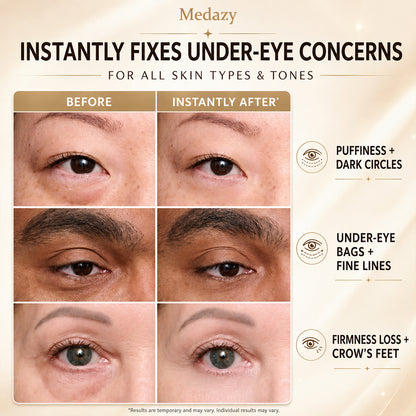 Medazy Instant Face Tightener – Visible Smoothing in 60 Seconds, Progressive Results in 18 Days