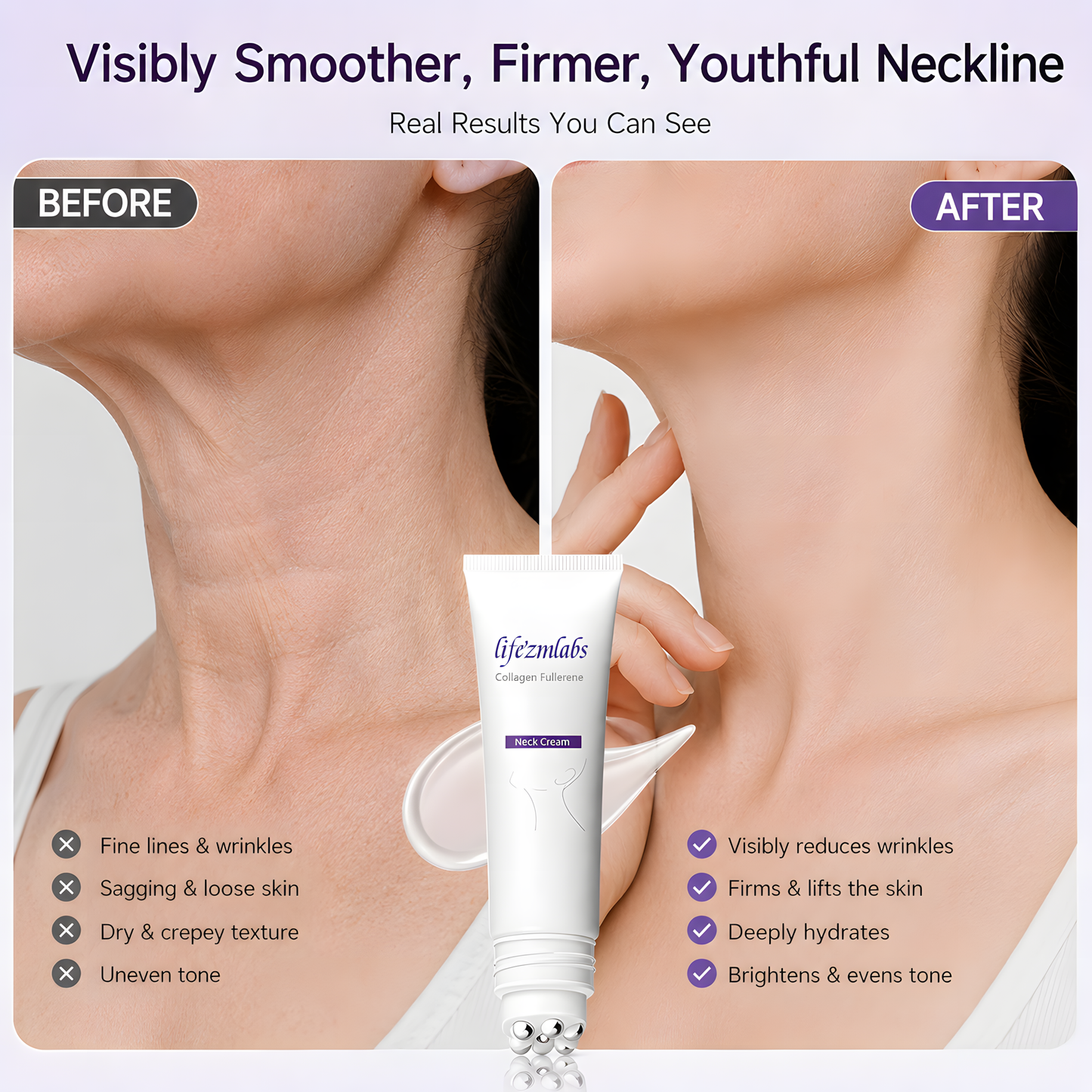 Reduces Wrinkles and Double Chin,Five Rollers for All Around Massage,Neck Firming Cream
