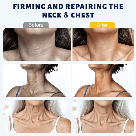 ✨ Lifezmlabs™ Instant Neck Lift Cream — 🧴 Infused with Retinol & Hyaluronic Acid | Firms the Neck, Reduces Wrinkles & Double Chin