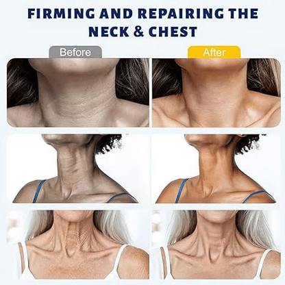 ✨ Lifezmlabs™ Instant Neck Lift Cream — 🧴 Infused with Retinol & Hyaluronic Acid | Firms the Neck, Reduces Wrinkles & Double Chin