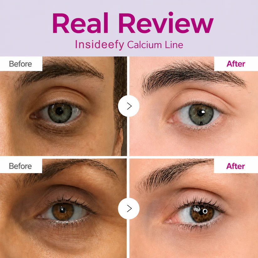 Cossetcare real review before and after