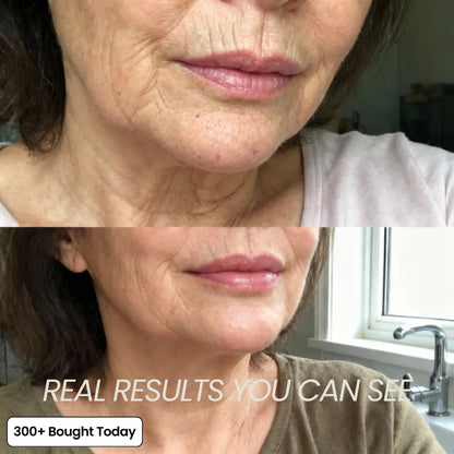🔥LAST DAY 60% OFF Lifezm®labs Korean Pink Collagen Volume Multi Balm